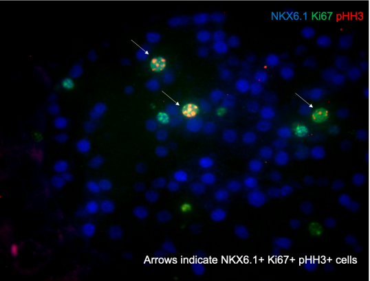 beta cell proliferation